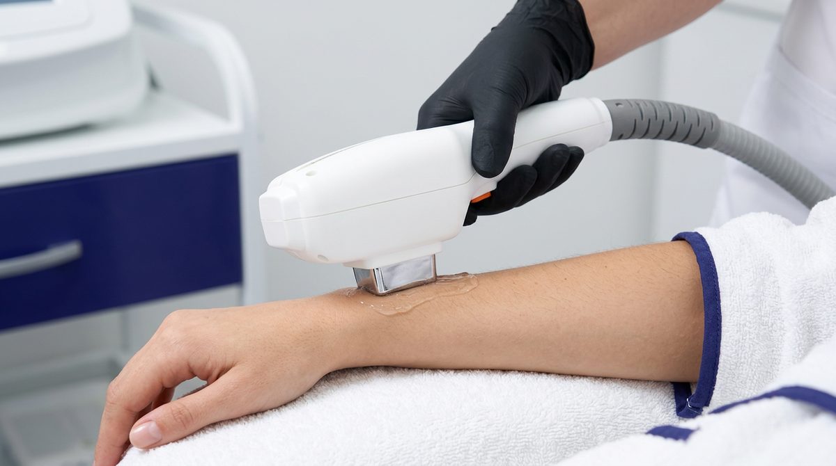 Тестовая вспышка перед лазерной эпиляцией: манипула Estetica Diode на коже предплечья